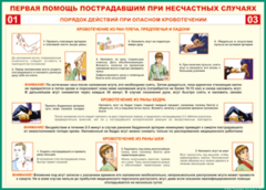 Таблица "Порядок действий при опасном кровотечении" (100х140 сантиметров, винил) - fgospostavki.ru - Уссурийск