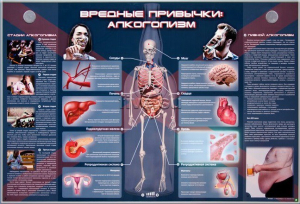 Электрифицированный стенд "Вредные привычки: алкоголизм" - fgospostavki.ru - Уссурийск